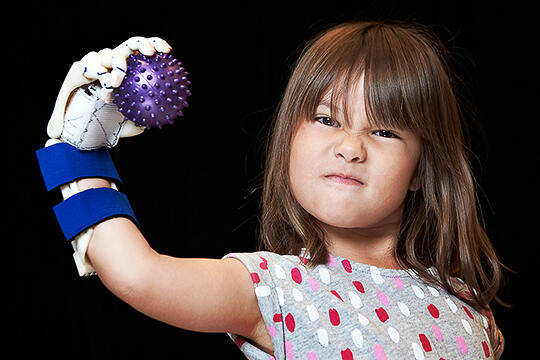 Four-year-old Hailey Dawson shows off mechanical hand
